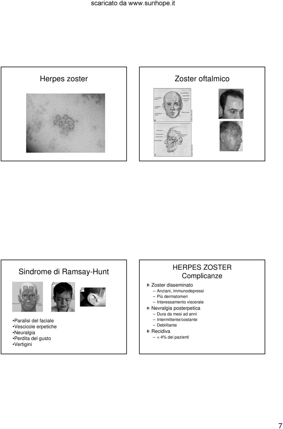 disseminato Anziani, immunodepressi Più dermatomeri Interessamento viscerale