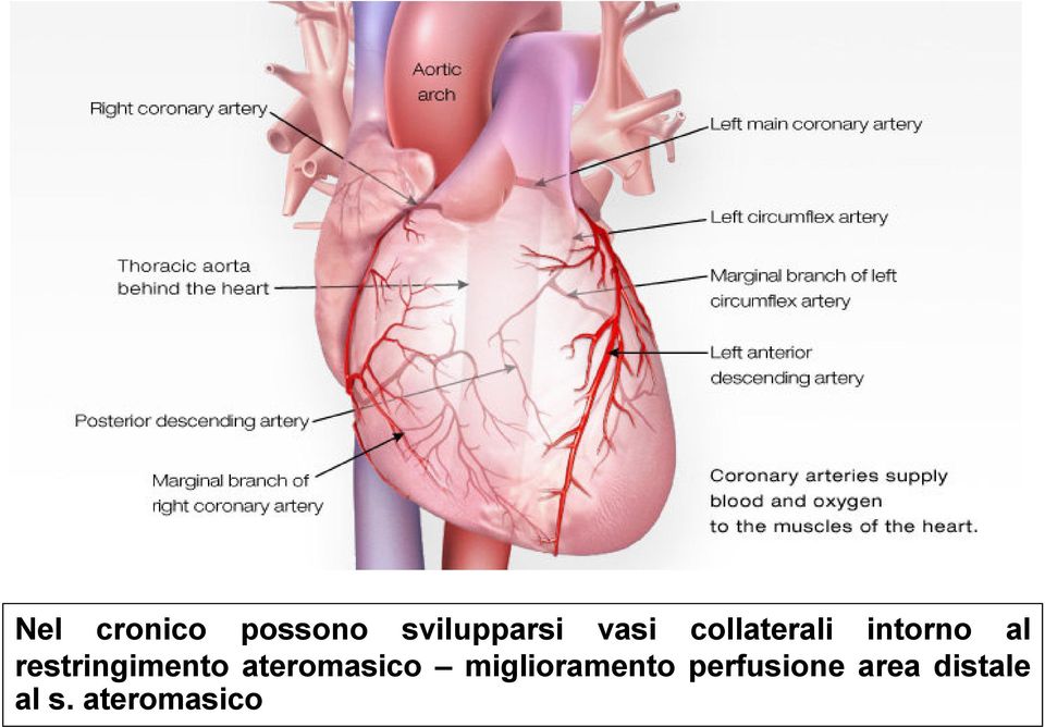 restringimento ateromasico