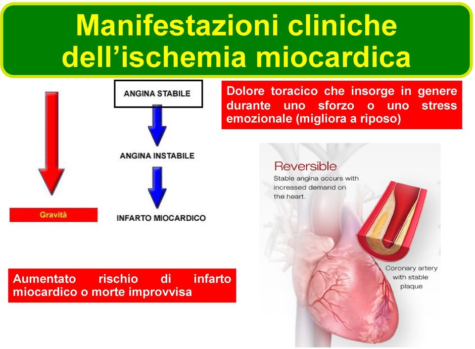 sforzo o uno stress emozionale (migliora a riposo)