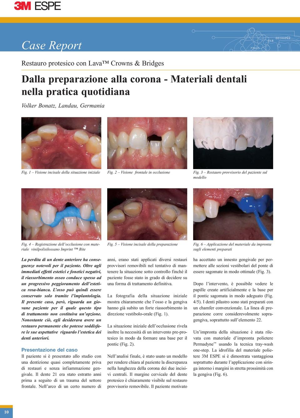 4 Registrazione dell occlusione con materiale vinilpolisilossano Imprint Bite La perdita di un dente anteriore ha conseguenze notevoli per il paziente.