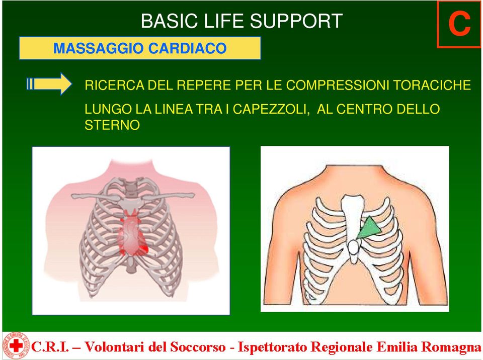 TORACICHE LUNGO LA LINEA TRA I