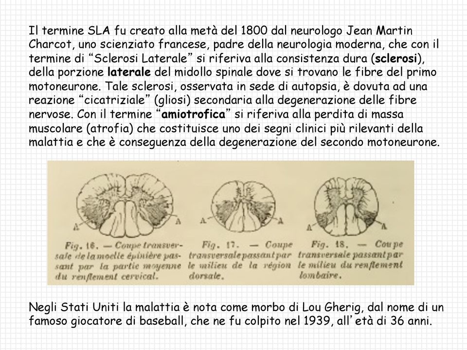 Tale sclerosi, osservata in sede di autopsia, è dovuta ad una reazione cicatriziale (gliosi) secondaria alla degenerazione delle fibre nervose.