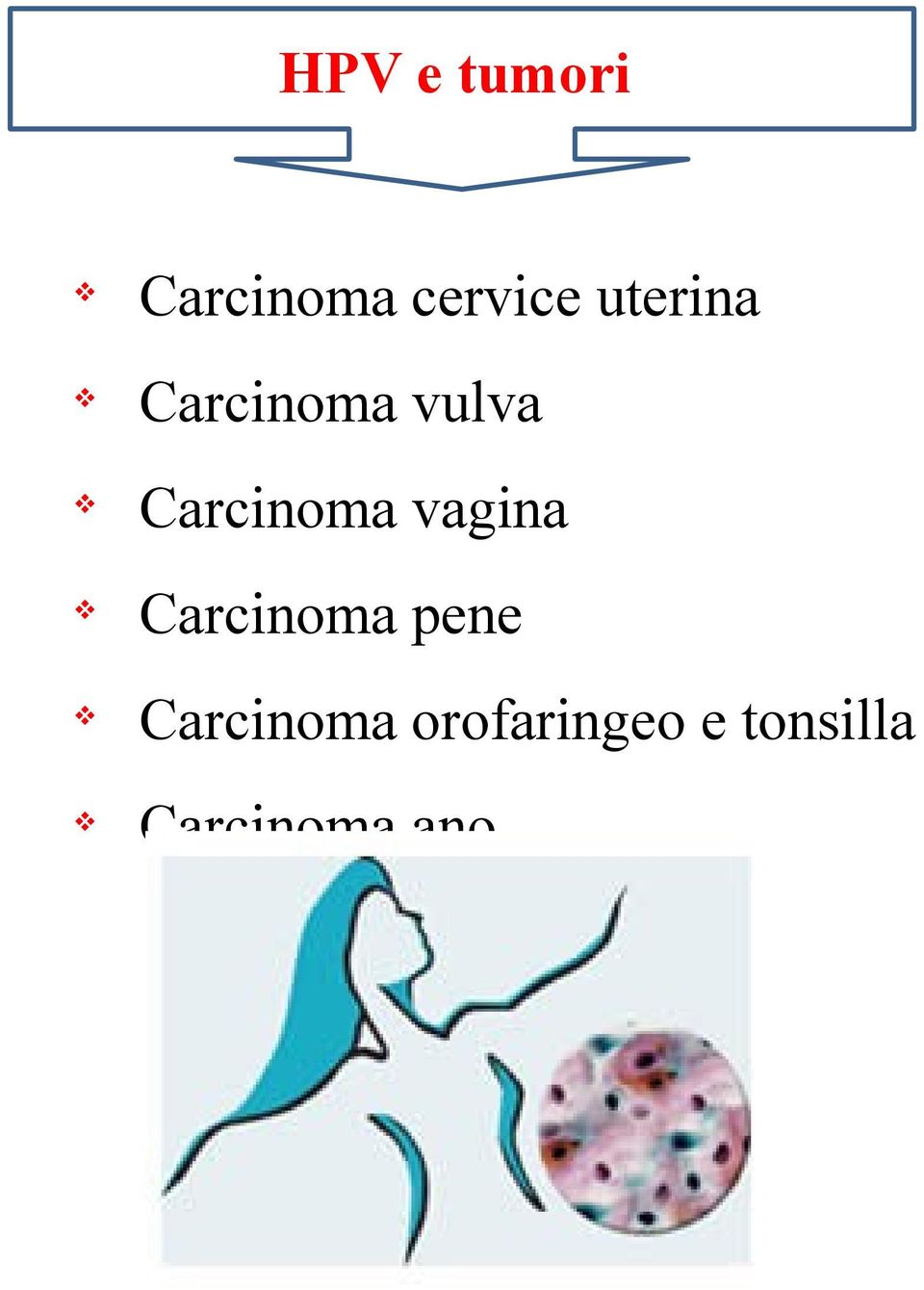 agina Carcinoma pene Carcinoma