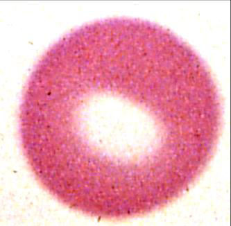La membrana cellulare al TEM (struttura trilaminare) eritrocito 7,5 nm plasmalemma Eritrocito al MO. Sezione al microscopio elettronico a trasmissione (TEM).