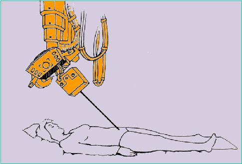 Proiezione inlet Tubo RX inclinazione cranio-caudale 45-60 Deviazioni sul