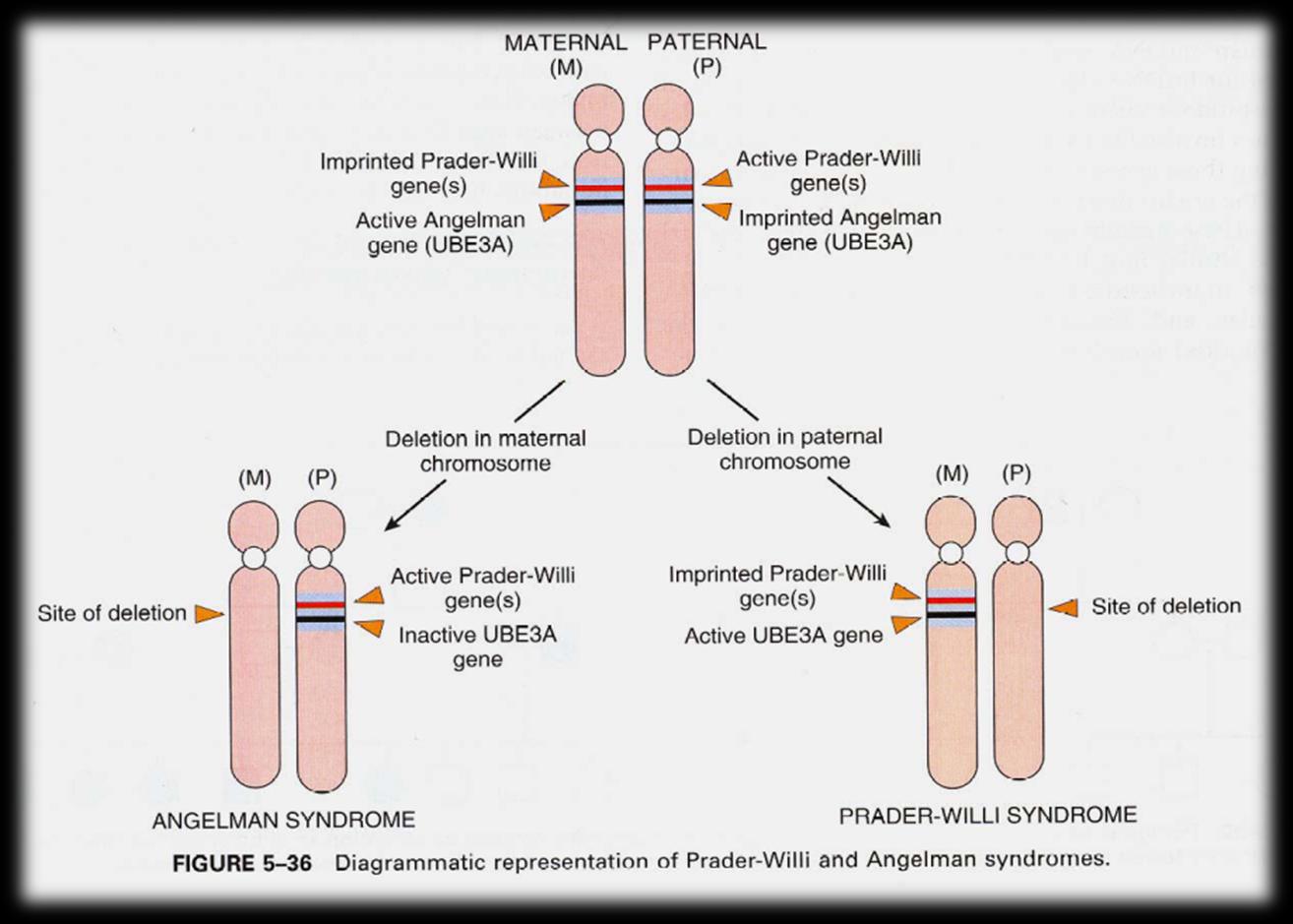 LA GENETICA DELLE MALATTIE DI E DI Le due malattie sono di solito causate da una microdelezione che colpisce il braccio lungo del cromosoma 15 ma, mentre nella PWS il cromosoma colpito è quello di