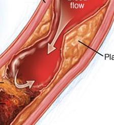 Strategia anti-ischemia nella cardiopatia cronica Terapia iniziale TERAPIA FARMACOLOGICA PCI CABG ISCHEMIA PERSISTENTE /