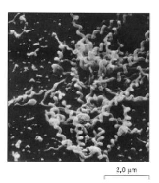 Alcune forme di batteri Cocchi ( sferica )