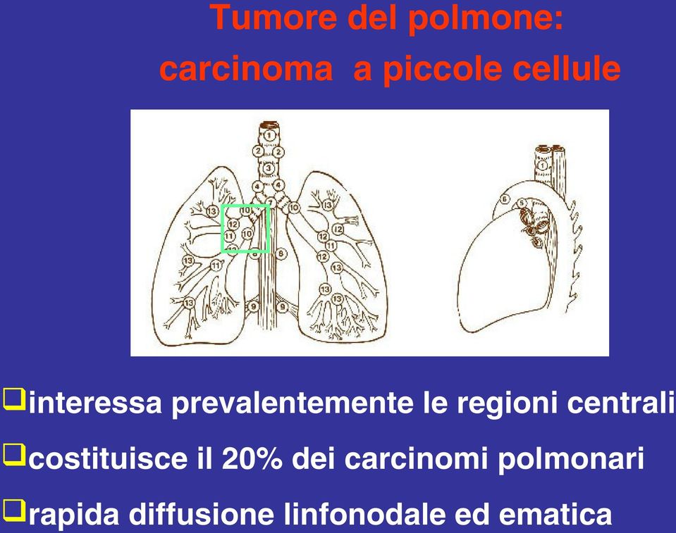 centrali costituisce il 20% dei carcinomi