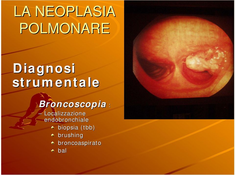 Localizzazione