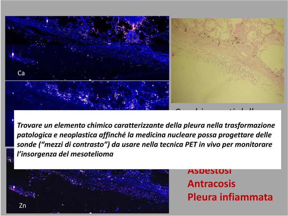 mezzi di contrasto ) da usare nella tecnica PET in vivo per monitorare l insorgenza del