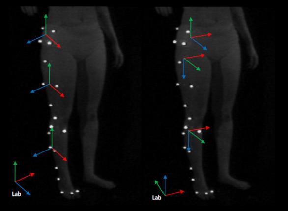 ANALISI DEL CAMMINO IN AMBIENTE TERRESTRE Per confrontare le coordinate anatomiche rilevate con le 2 tecniche