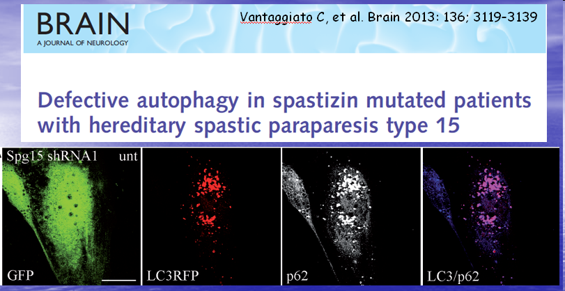 Fisiopatologia Lipidomica & Metabolismo Acidi Grassi Autofagia: