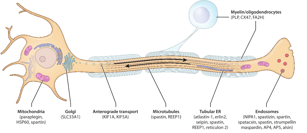 Clues for a priority MR/Decline (in SPG11, SPG15, SPG21, SPG27, SPG32, SPG35, ) but also in SPG1 Peripheral neuropathy (in SPG7, SPG11, SPG15,