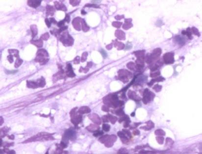 Cellule mieloidi Midollo Pool proliferativo Pool maturativo