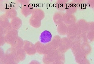 Leucociti agranulociti agranulociti I leucociti, o globuli bianchi, sono incaricati della difesa dell'organismo. Sono assai meno numerosi dei globuli rossi.