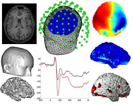 Le metodologie di esplorazione funzionale in vivo del cervello - Vantaggi Caratterizzazione anatomico-strutturale e funzionale in vivo del cervello