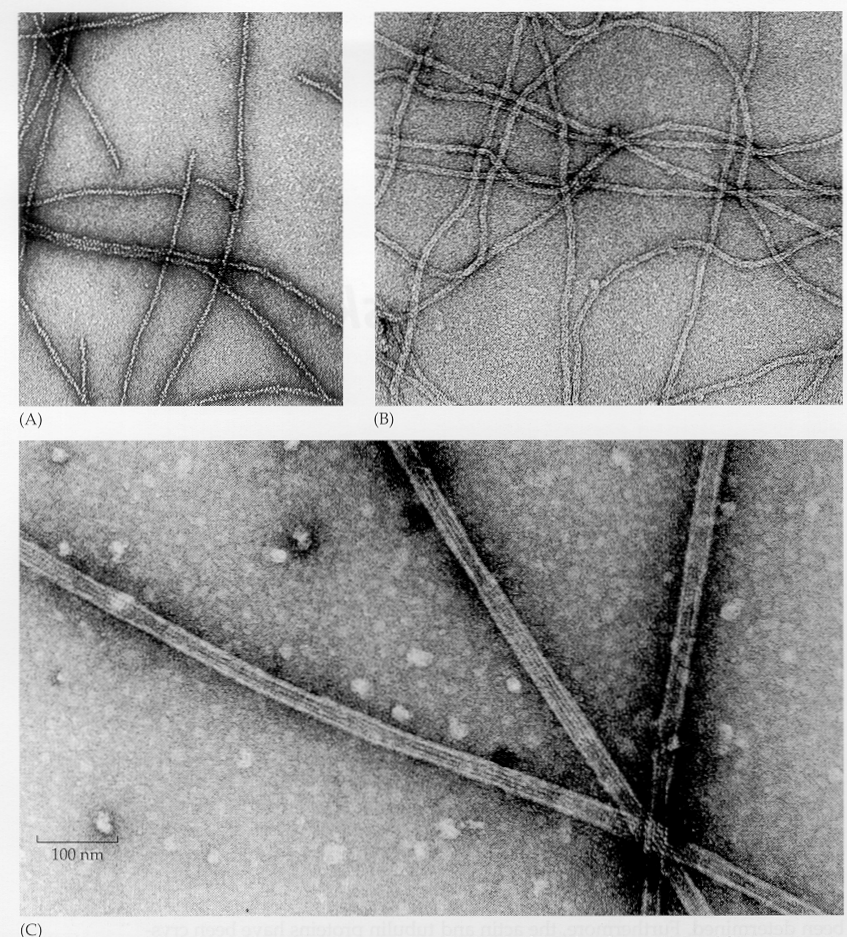 citoscheletro: filamenti tre tipi di filamenti: microfilamenti actina diametro 6 nm filamenti intermedi cheratina, vimentina (desmina, proteina acida della glia), proteine dei