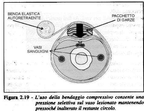 EMORRAGIE ESTERNE Visibile perdita ematica, si distinguono: