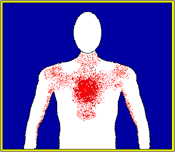 SEGNI DI ALLARME DELL INFARTO MIOCARDICO - dolore al centro del torace o alla mandibola, alla gola o simile al mal di