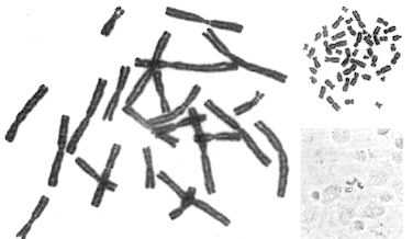 Parametri per il cariotipo (1): le dimensioni dei cromosomi