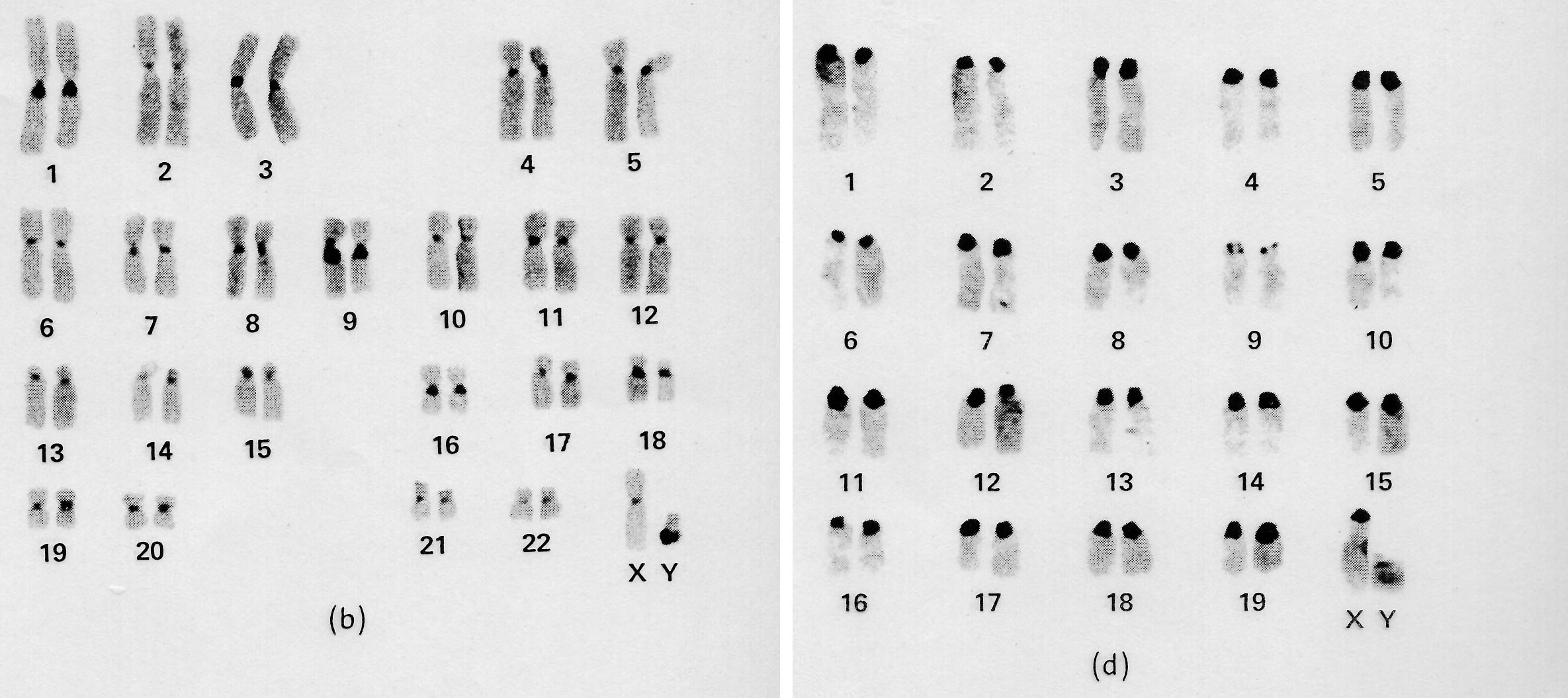 Il numero e la morfologia dei cromosomi sono costanti nelle varie specie Uomo Topo
