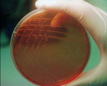 Ricerca di Campylobacter su Campylobacter selective agar Il terreno contiene: Antibiotici: vancomicina, polimixina B, trimetoprim, cefalotina, amfotericina B Carboidrati: destrosio Peptoni, estratto