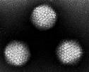 Adenovirus e Rotavirus Famiglia Adenoviridae Virus a DNA Affezioni che interessano soprattutto le vie respiratorie, ma possono interessare anche l apparato digerente e gli occhi Periodo di