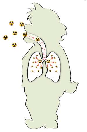 Il Radon è poco reattivo, non si deposita sulle pareti dell apparato bronco-polmonare ed è facilmente eliminabile per via respiratoria.