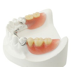 Protesi con attacchi di precisione Se avete perso dei denti in modo discontinuo, tale da non permettere l inserimento dei classici ponti dentali e, al contempo, per ragioni di varia natura, non
