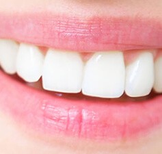 Estetica dentale Offriamo la bellezza di un sorriso attraente, curando nei minimi dettagli l aspetto dei vostri denti.