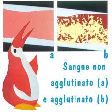 GRUPPI SANGUIGNI Il gruppo sanguigno è una delle numerose caratteristiche di un individuo, proprio come il colore degli occhi e dei capelli, ed è geneticamente determinato alla nascita.