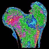 Combinazione delle immagini Analogamente l immagine di T1/T2 mostrata nella figura sotto, permette di evidenziare caratteristiche biomorfologiche non chiaramente