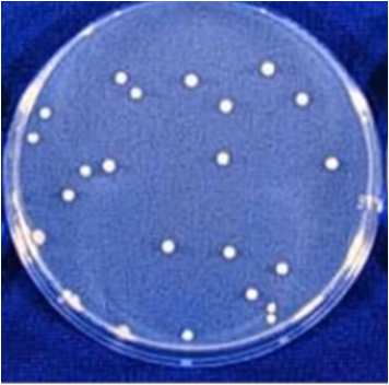 N.B.: al fine di stabilire nel modo più corretto possibile la carica microbica vitale di un campione, non si considerano solo le colonie di una singola piastra ad una singola diluizione, ma si