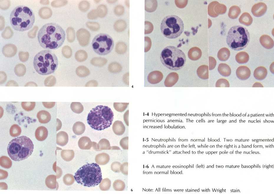 neutrofili polimorfonucleati monociti linfociti