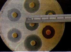 Risultati Le più frequenti patologie umane sono causate da ceppi resistenti di Salmonella spp. e Campylobacter spp.