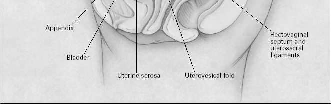 LOCALIZZAZIONE PELVICA ED ADDOMINALE DELL ENDOMETRIOSI CLASSIFICAZIONE DELL ENDOMETRIOSI