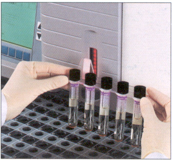 BACTEC MT 960 AST Fiale liofilizzate dei farmaci ricostituite con ml acqua distillata sterile.