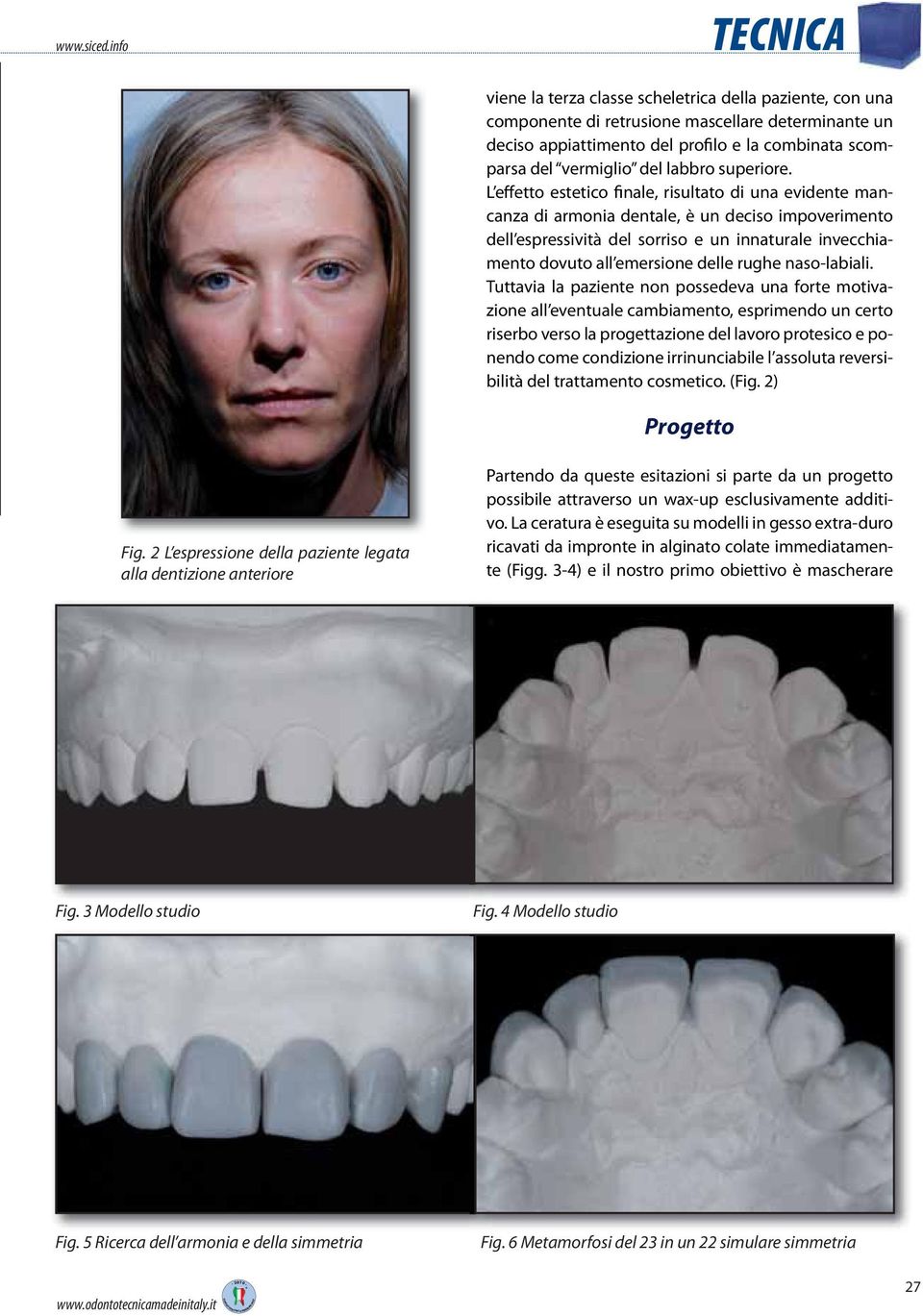 L effetto estetico finale, risultato di una evidente mancanza di armonia dentale, è un deciso impoverimento dell espressività del sorriso e un innaturale invecchiamento dovuto all emersione delle