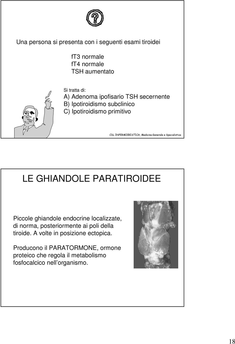 PARATIROIDEE Piccole ghiandole endocrine localizzate, di norma, posteriormente ai poli della tiroide.