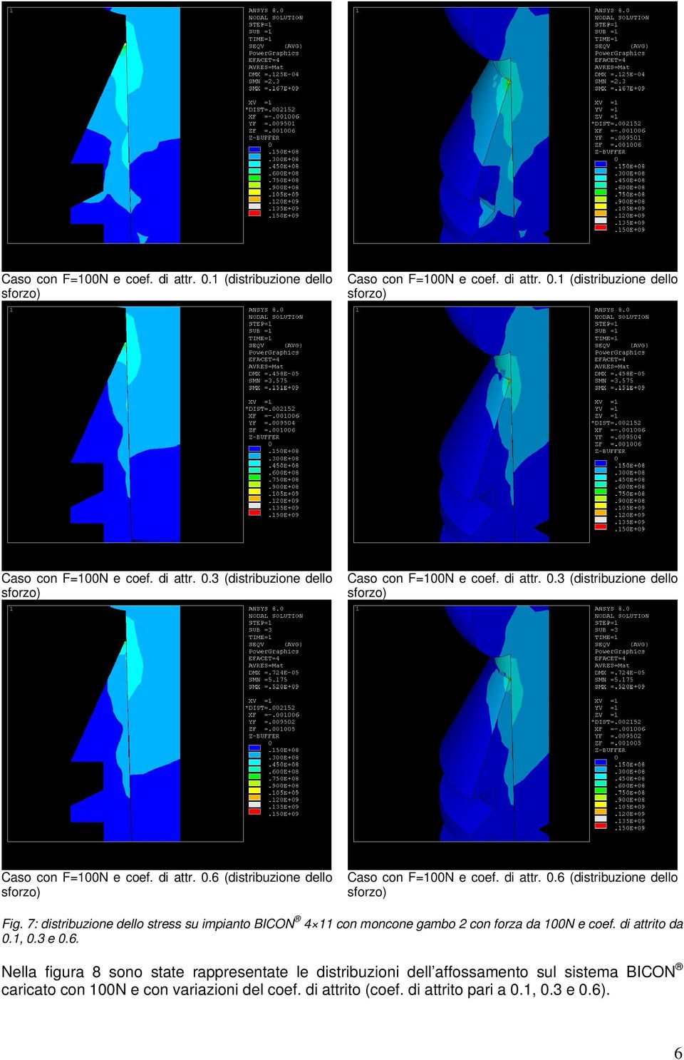 7: distribuzione dello stress su impianto BICON 4 11 con moncone gambo 2 con forza da 100N e coef. di attrito da 0.1, 0.3 e 0.6.