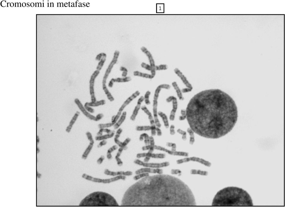 metafase