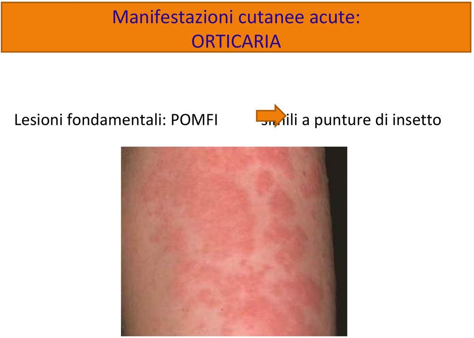 Lesioni fondamentali: