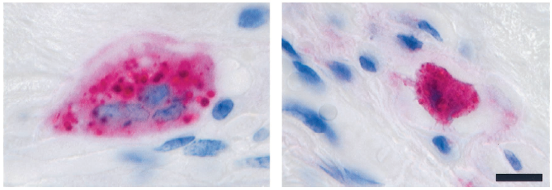 la funzione e la sopravvivenza degli osteoclasti Adattato da Boyle WJ, et al. Nature. 2003;423:337-42 Adattato da Russell RGG, et al. Ann NY Acad Sci.