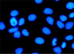 Microscopia a fluorescenza Nella microscopia in fluorescenza i preparati vengono trattati con reagenti speciali, le cui singole molecole sono in grado di assorbire la luce per un tempo