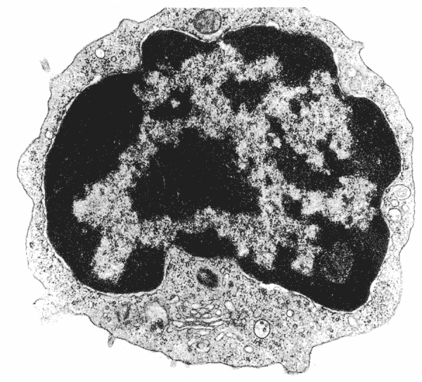 Esempio di microscopia elettronica a trasmissione Le immagini di microscopia elettronica sono in bianco e nero.