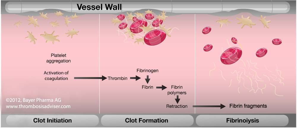 http://www.thrombosisadviser.com/scripts/include/tfw/tools/download.php?f=/html/images/library/haemostasis/fibrinolysisclot formation HR.
