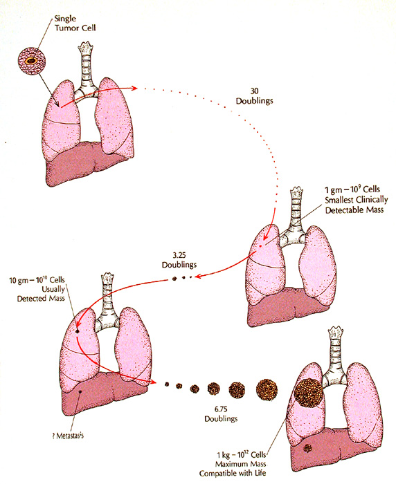 From Biology of Tumour