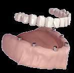 Fig. 7 Fig. 8 Fig. 9 Quando vi è la totale mancanza dei denti dell arcata inferiore (mandibola) (Fig.