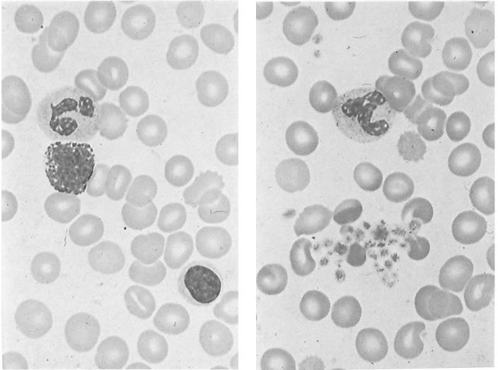 Gli elementi figurati del sangue: granulociti